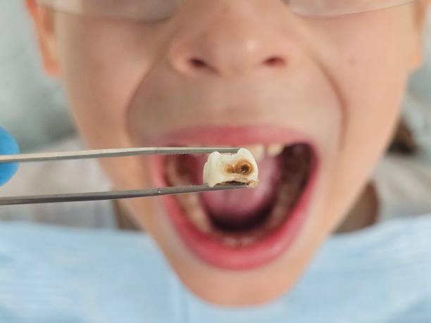 Best Same-Day Emergency Dental Services in Malvern, AR
